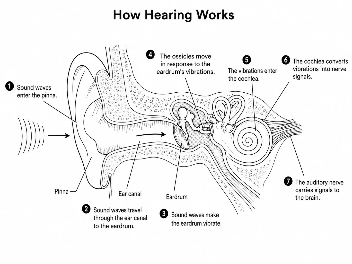Diagram showing the path of sound waves through the outer, middle, and inner ear.
