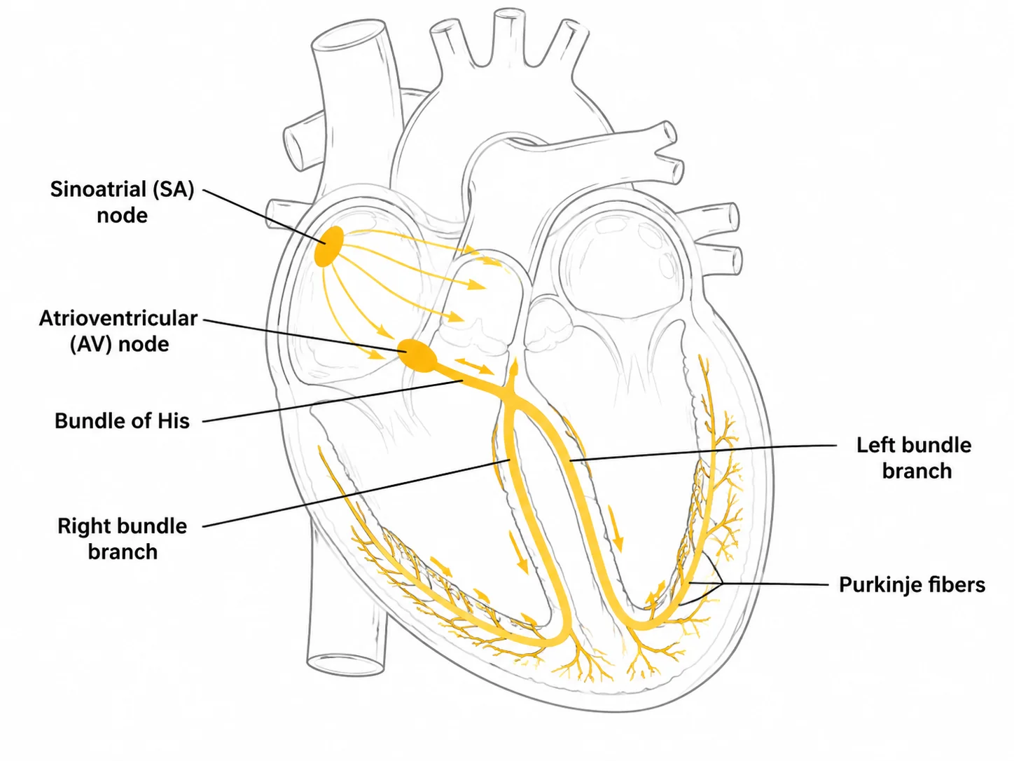Heart diagram showing the SA node, AV node, bundle of His, and Purkinje fibers.